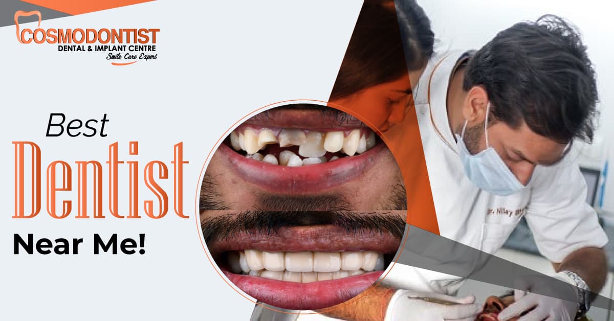 10 Small Changes That Will Have A Huge Impact On Your Clove Dentistry in Dwarka