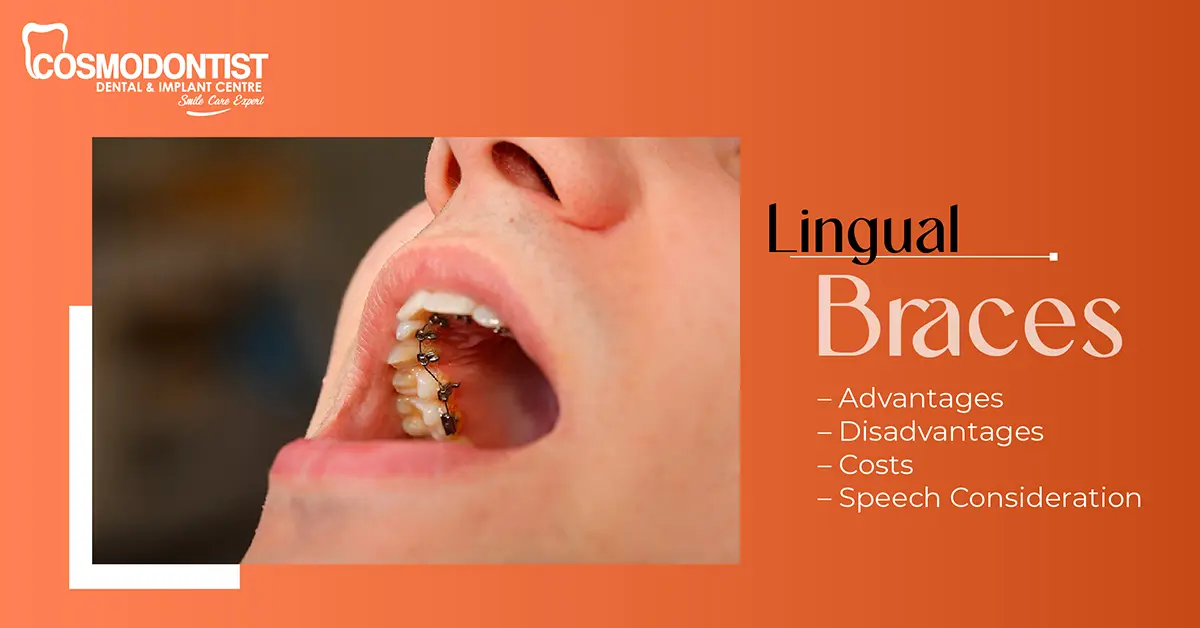 Lingual Braces Advantages & Disadvantages